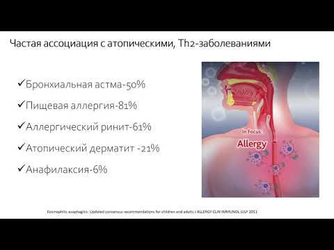 Видео: Круглый стол «Эозинофильный эзофагит у детей и взрослых»