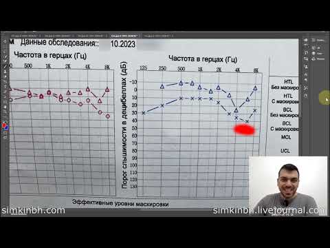 Видео: Неправильные замеры слуха у врача: до 8000Гц и 20000Гц (тональная аудиометрия)