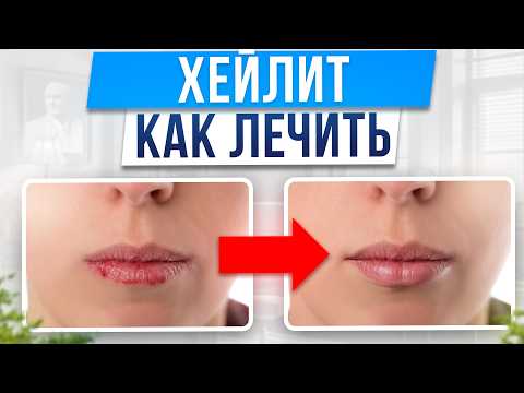 Видео: ПРАВИЛЬНЫЙ уход за губами в домашних условиях! / Что такое хейлит на губах и как с ним бороться?
