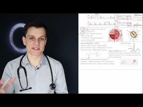 Видео: ЭКГ за 100 минут №3: Научись читать ЭКГ за 10 минут!!! Простой алгоритм