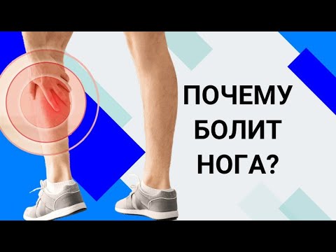 Видео: ПОЧЕМУ БОЛИТ НОГА? Сосуды или позвоночник?