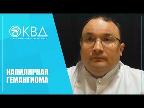 Видео: 1288  Капилярная гемангиома