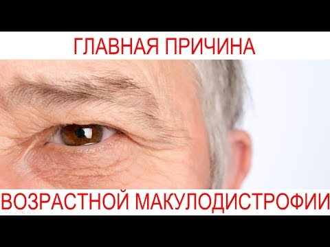 Видео: Причина возрастной макулодистрофии. Центр Ока