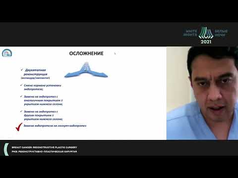 Видео: Реконструкция после реконструкции. Миф или реальность (Зикиряходжаев А.Д.)