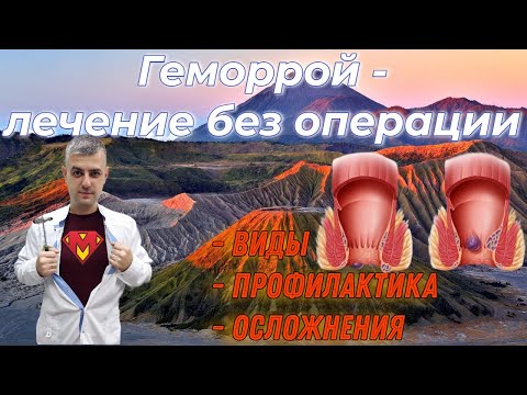 Видео: Геморрой | Виды | Профилактика | Осложнения |