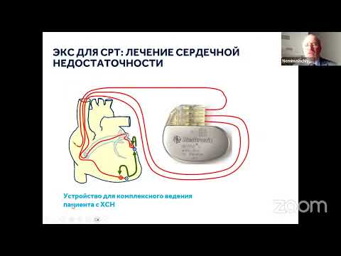 Видео: Основы СРТ: показания, критерии диагностики, основы программирования и интерпретации