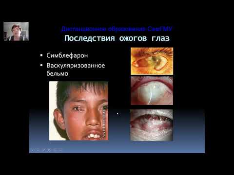 Видео: Повреждения глаз часть 3
