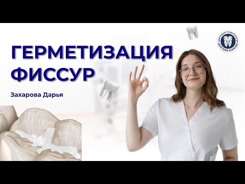 Видео: Герметизация фиссур