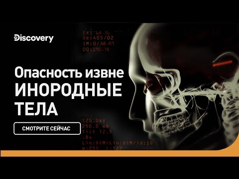 Видео: Опасность извне | Инородные тела | Discovery