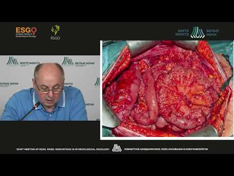 Видео: Определение перитонеального индекса карциноматоза у больных распространённым раком яичников