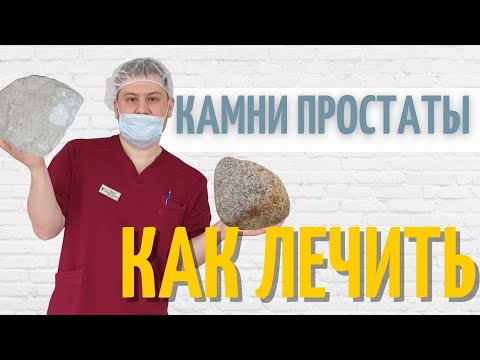 Видео: Камни простаты | Как избавиться от калькулёзного простатита |