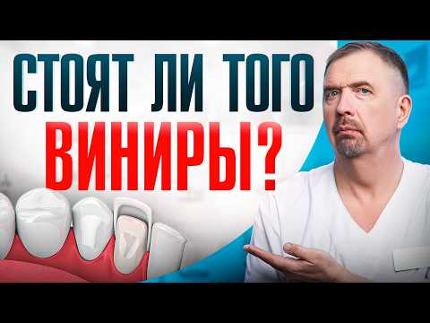 Видео: ВИНИРЫ: ЗА и ПРОТИВ? И какие они бывают?