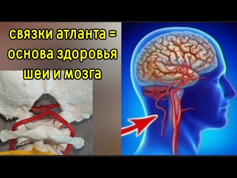 Видео: Жизнь мозга и шеи зависит от зажатого большого затылочного отверстия. Методы декомпрессии