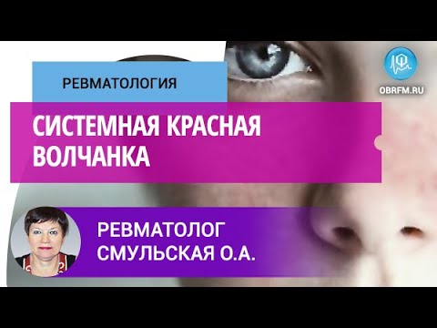 Видео: Ревматолог Смульская О.А.: Системная красная волчанка
