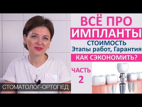 Видео: Импланты (часть 2): стоимость имплантации, цена составных частей импланта, гарантия,дешевые импланты