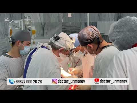 Видео: Ошқозон саратони (раки), ундан яна бир беморимиз қутулди!