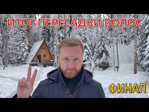 Видео: ИТОГ ДВУХ ПЕРЕСАДОК ВОЛОС. ФИНАЛЬНЫЙ ОТЧЕТ.