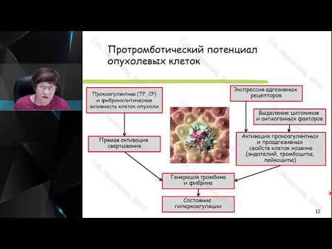 Видео: Профессор Вавилова Т. В. :  Рак и тромбоз