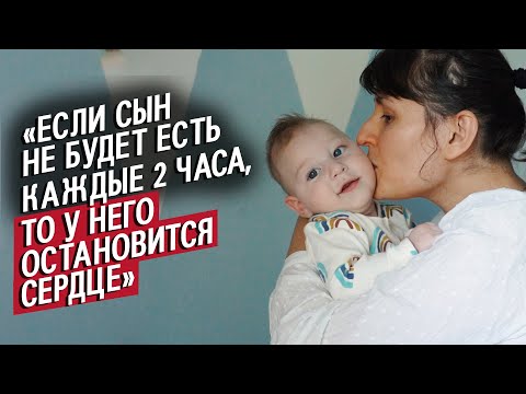 Видео: Мой сын живет без части мозга: Рада | Быть мамой