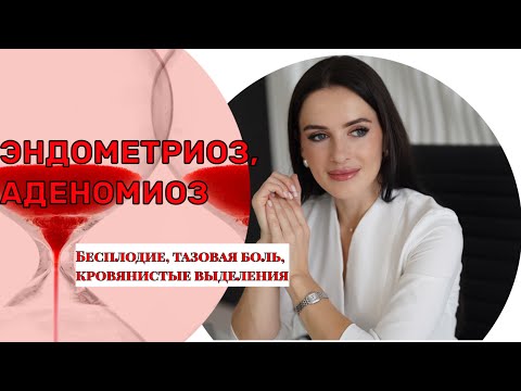 Видео: Эндометриоз, аденомиоз или диффузные изменения в миометрии, что это и как с этим жить?