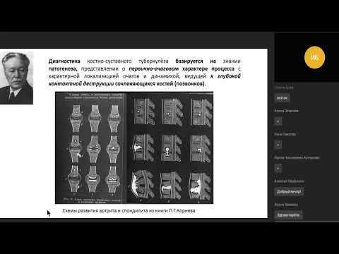 Видео: Рентгенодиагностика туберкулеза костей и суставов на примере клинических случаев