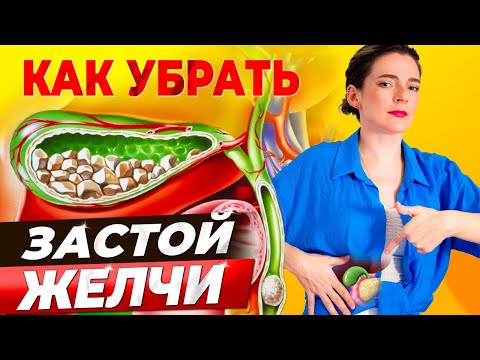 Видео: ГУСТАЯ ЖЕЛЧЬ? КАК РАЗОГНАТЬ ЖЕЛЧЬ БЕЗ ЛЕКАРСТВ! Камни, хлопья, сладж, высокий холестерин