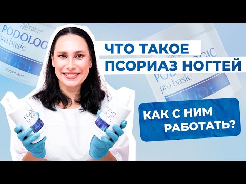 Видео: Что такое псориаз ногтей и как с ним работать?