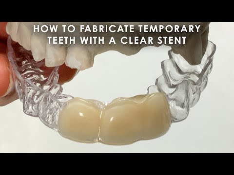 Видео: Как изготовить временные зубы с прозрачным стентом
