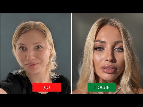 Видео: Мои инъекции красоты, взгляд на жизнь, воспитание детей и отношения