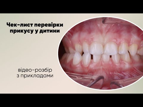 Видео: Чек-лист перевірки прикусу у дитини | Ортодонт Б.В. Свінціцький