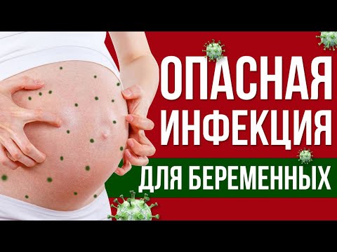 Видео: Совсем не безобидная инфекция: ветрянка при беременности