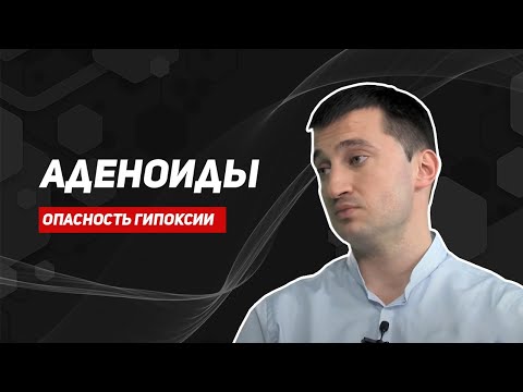 Видео: Аденоиды/лечение аденоидов/удаление аденоидов/детский лор/отоларинголог