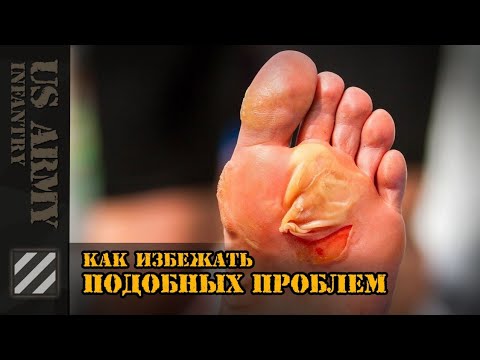 Видео: Как избежать подобных проблем раз и навсегда.