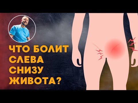 Видео: Что болит СЛЕВА СНИЗУ ЖИВОТА? 