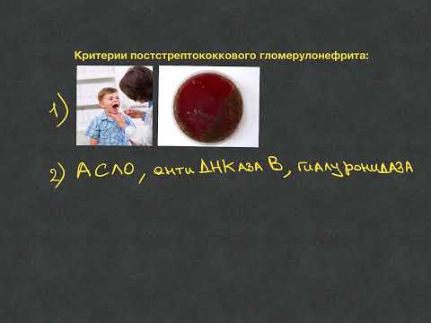 Видео: Постстрептококковый гломерулонефрит.