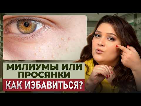 Видео: Как БЫСТРО убрать МИЛИУМЫ на лице в домашних условиях? Как ИЗБАВИТЬСЯ от белых точек