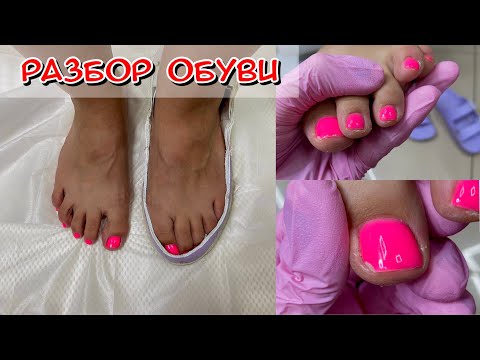 Видео: Разбор обуви / Скалывается гель лак / Почему? / Сухая кожа на пальцах ног что делать