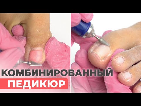 Видео: Комбинированный ПЕДИКЮР | Обработка пальцев ног пошагово