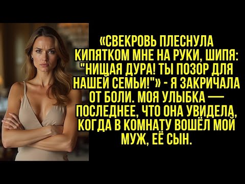 Видео: Свекровь плеснула кипятком мне на руки, шипя- ''Нищая дура! Ты позор для нашей семьи!''.