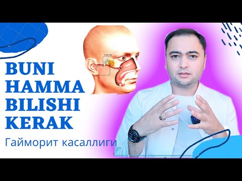Видео: #LAYKBOSING #OBUNALING     ХАММА БИЛИШИ ШАРТ, ГАЙМОРИТДАН САКЛАНИШ, ГАЙМОРИТ КАНДАЙ КАСАЛЛИК?
