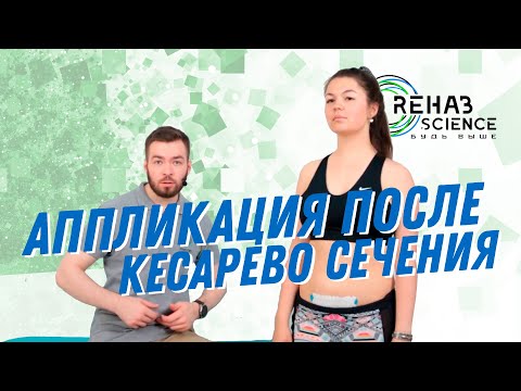 Видео: Кинезиотейпирование после кесарево сечения. Кинезиотейпирование живота.