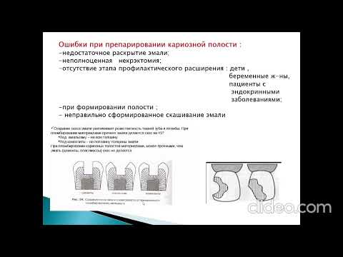 Видео: Распространенные ошибки и осложнения при диагностике и лечении кариеса