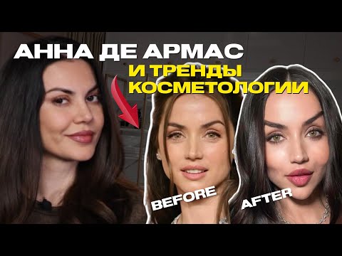 Видео: АННА ДЕ АРМАС: естественное преображение Анны VS уродливые тренды косметологии