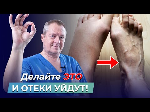 Видео: УСТАЛИ ОТ ОТЕКОВ? Узнайте, как быстро ИЗБАВИТЬСЯ ОТ ОТЕКОВ и улучшить кровоток в организме!