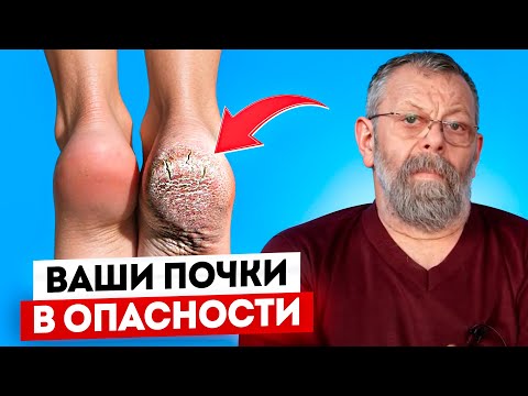 Видео: Шелушатся пятки? 5 признаков, когда ваши почки просят помощи.