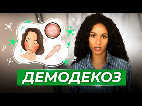 Видео: ДЕМОДЕКС // ДЕМОДЕКОЗ: как и чем лечить?