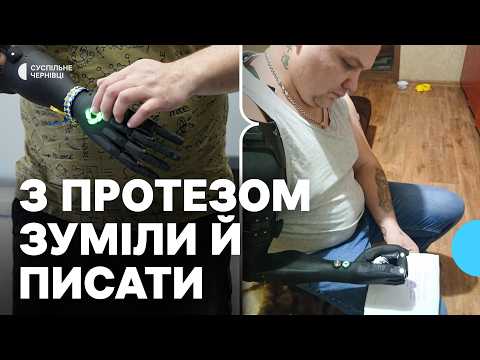 Видео: “Реагують так, ніби – це магія”: як у Чернівцях виготовляють біонічні протези рук для військових
