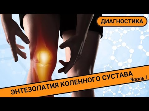 Видео: ПОЧЕМУ БОЛИТ КОЛЕНО? || Энтезопатия коленного сустава. Диагностика (Часть 1)