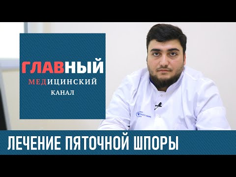 Видео: Лечение пяточной шпоры. Как и чем лечить пяточную шпору. Плантарный фасциит стопы