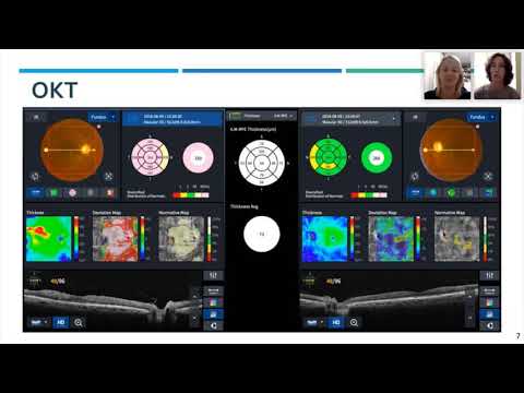 Видео: ОКТ и ОКТ ангиография в диагностике диабетической ретинопатии